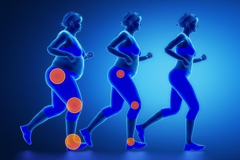 Chronic Pain, Obesity, and Mental Health: A Biopsychosocial Approach to Healing